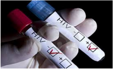 Java Evropiane e testimit të HIV organizohet edhe në Maqedoni
