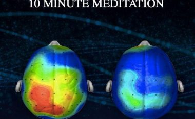 Neuroshkencëtarët e zbulojnë KËNGËN e cila e zvogëlon SHQETËSIMIN për 65 për qind (Audio)