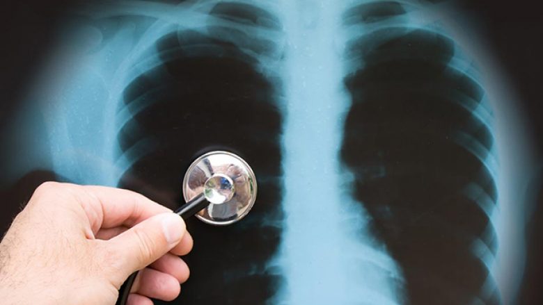 A mund të shërohet pneumonia brenda pak orëve, në mënyrë natyrale? (Video)