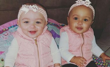 E pabesueshme: Lindin binjakët e dy racave të ndryshme (Foto)