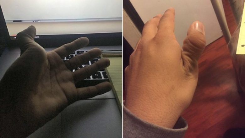 Trendi i ri morbid në internet: Fëmijët thyejnë gishtat! (Foto, +16)