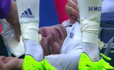 Kovacic duket se ka shpëtuar nga ndonjë dëmtim serioz në sy (Foto/Video)