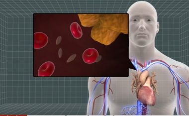Testet e gjakut mund të parashikojnë sulmin në zemër (Video)