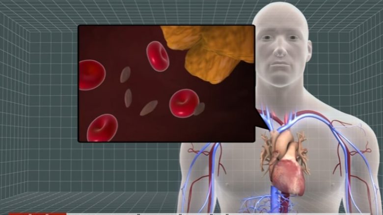 Testet e gjakut mund të parashikojnë sulmin në zemër (Video)