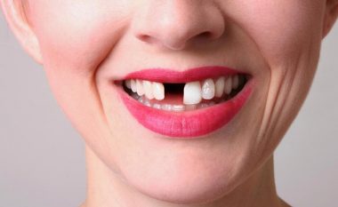 Numri i dhëmbëve që i keni nxjerrë do t’jua zbulojë sa gjatë do të jetoni