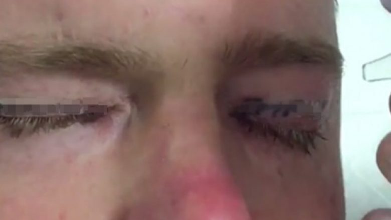 Kaloi 72 orë duke u shfrenuar nëpër ahengje plot alkool, kur u zgjua e kuptoi çfarë u kishte bërë syve (Foto/Video)