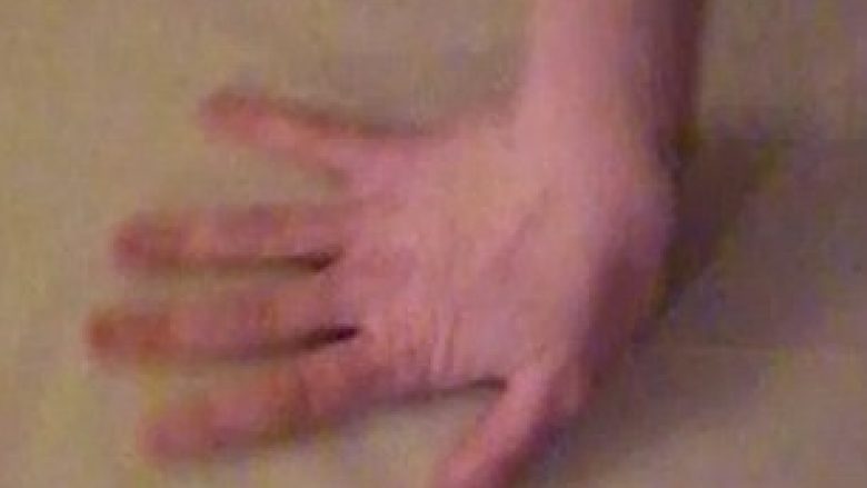 Rrotullon dorën për 360 shkallë, veprimi tij konsiderohet i pështirë (Video)
