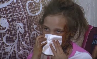 Vajza me plagë nga djegia kthehet në shtëpi, nëna nuk ka para ta shoqërojë atë në spital! (Video)
