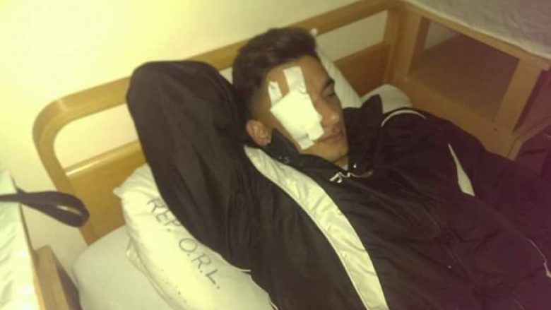 Memaj i Lirisë e përzë nga spitali futbollistin që e lëndoi
