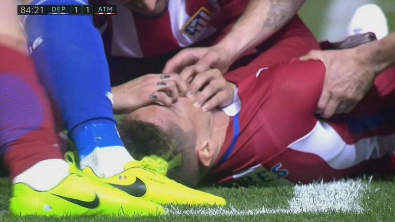 Torres pëson lëndim të rëndë dhe mbet pa ndjenja, largohet me urgjencë nga fusha (Foto/Video)