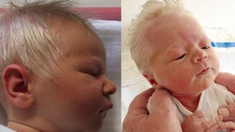 Lind bebja me flokë plotësisht të bardha: Mjekët e shokuar nuk po mund ta shpjegojnë si ndodhi kjo  (Foto)