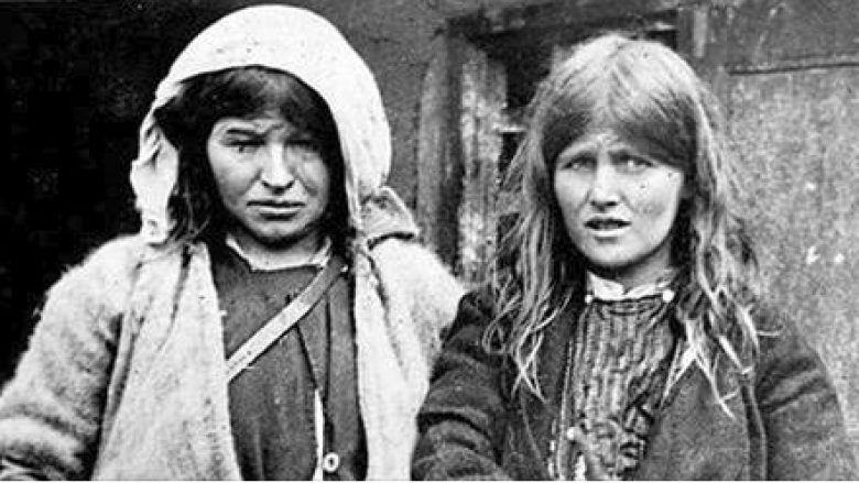 Historia prekëse e këtyre dy motrave shqiptare që ‘tronditi’ botën (Foto)
