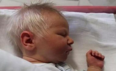I befasoi mjekët kur u lind: Fotografia e vogëlushit me arsye ka përshkuar botën! (Video)