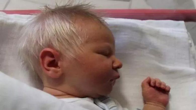 I befasoi mjekët kur u lind: Fotografia e vogëlushit me arsye ka përshkuar botën! (Video)