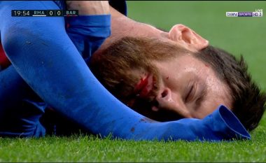 Gjakoset Messi nga bërryli i Marcelos (Video)