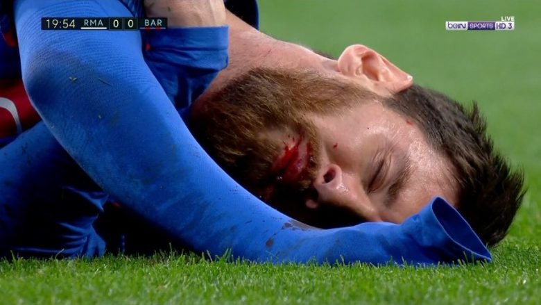 Gjakoset Messi nga bërryli i Marcelos (Video)