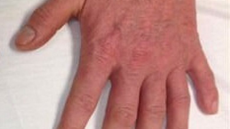 Duart e veçanta me nga një gisht shtesë (Foto)