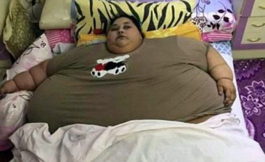 Peshonte afro 500 kilogramë, gjatë tretmanit dymujorë humbi gjysmën e peshës (Foto)