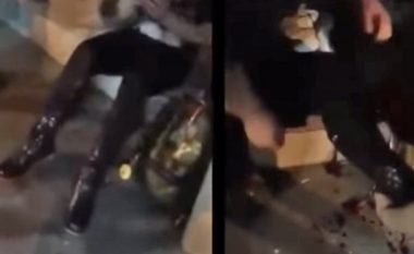 Shpërthimi në Mançester ia copëton këmbët vajzës (Video, +18)