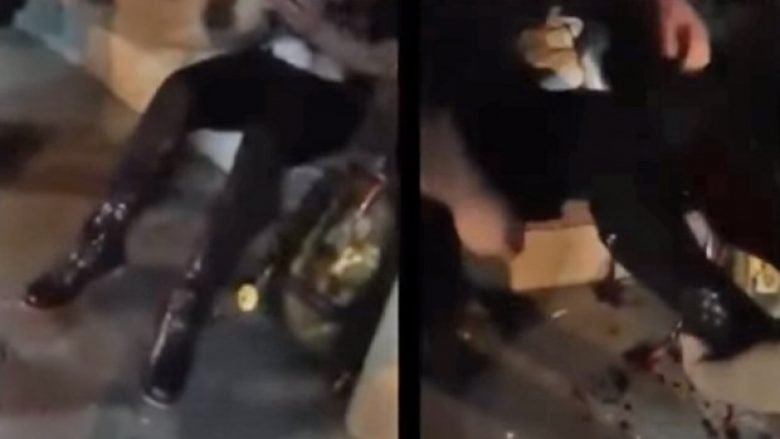 Shpërthimi në Mançester ia copëton këmbët vajzës (Video, +18)