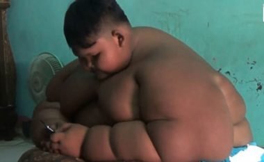 Është vetëm 10-vjeçar, por peshon 110 kilogramë (Foto)