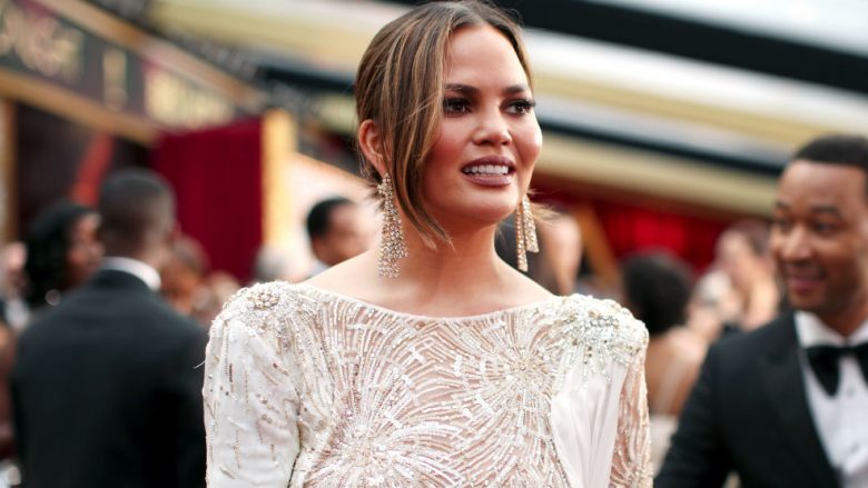 Chrissy Teigen: Gjithçka në mua është false, bukurinë e kam falë ndërhyrjeve kirurgjike