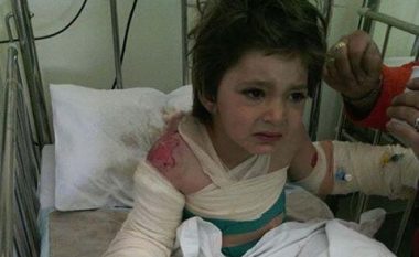 Apel për ndihmë për vogëlushen pesë vjeçare nga Mavrova, mori lëndime nga zjarri