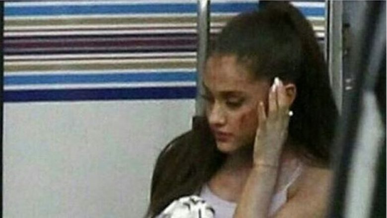 Mos i besoni këtyre lajmeve të rrejshme për sulmin në koncertin e Ariana Grande (Foto)