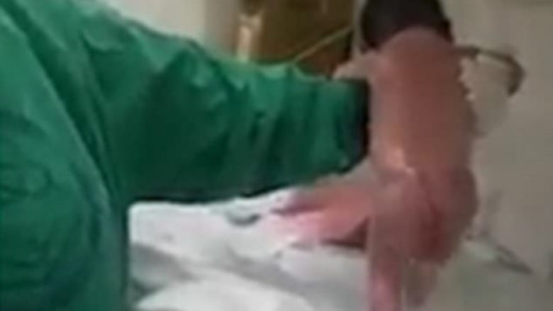 Infermierët mbesin pa fjalë: Foshnja fillon të ecë, vetëm pak minuta pas lindjes (Video)