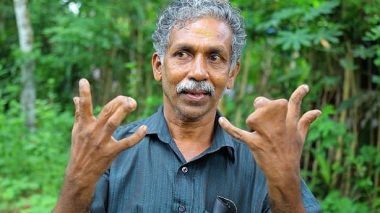 I gjithë fisi ka lindur me gishtat e duarve të ngjitur – kanë një shpjegim interesant për këtë! (Foto)