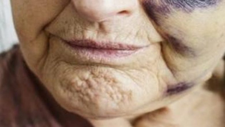 Dita për ndërgjegjësimin ndaj keqtrajtimit të të moshuarve