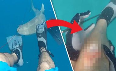 Pamje të frikshme: Derisa po peshkonte, peshkaqeni e sulmon duke i marrë “një copë këmbe” me vete (Video)