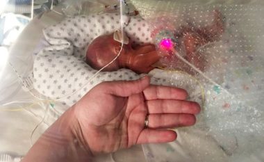 Foshnja e lindur shumë para kohe pritet të largohet nga spitali, zhvillimi i tij sfidoi edhe parashikimet e mjekëve (Foto)