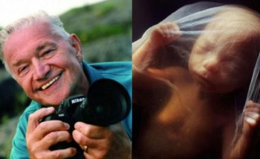 Fotografi i njohur e sjellë tërë procesin e lindjes së bebes përmes fotografive (Foto)