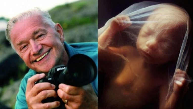 Fotografi i njohur e sjellë tërë procesin e lindjes së bebes përmes fotografive (Foto)