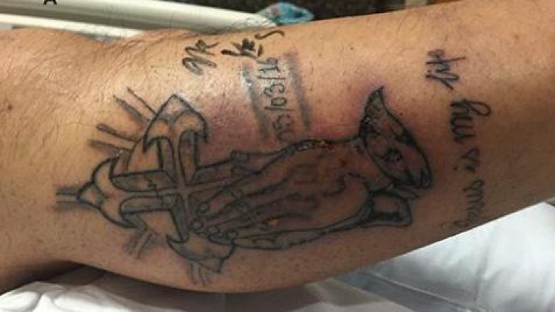 Vendosi një tatuazh, 31-vjeçari gjen vdekjen pasi injoroi këshillën që ia dhanë (Foto,+18)