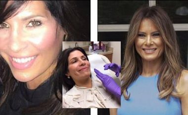 Tetë operacione, vetëm e vetëm që të përngjajë me Melania Trump! (Foto)
