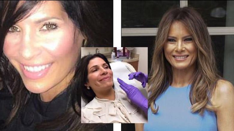 Tetë operacione, vetëm e vetëm që të përngjajë me Melania Trump! (Foto)
