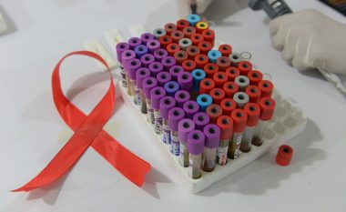 Çudia që i tmerroi mjekët: Djaloshit nëntëvjeçar të infektuar me HIV – fare nuk i nevojiten barnat! Shpresa e re për miliona të sëmurë në gjithë botën