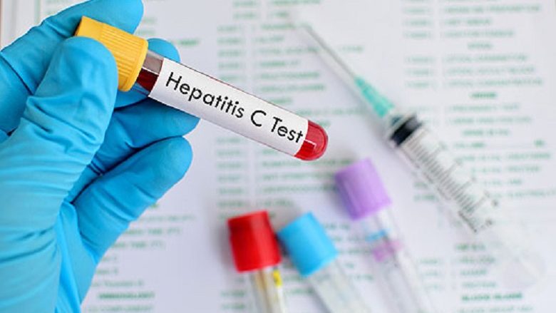 Çakarovski: Po përgatitet strategji kombëtare për eliminim të hepatitit deri në vitin 2030