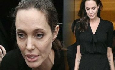 I ka vetëm 34 kilogram, Angelina Jolie pranë vdekjes (Foto)