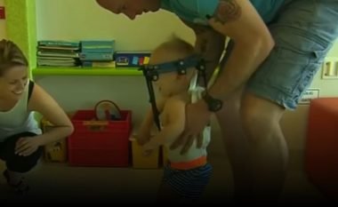 “I pritet koka” në një aksident, mjekët i ngjesin kokën fëmijës 16 muajshe (Video)