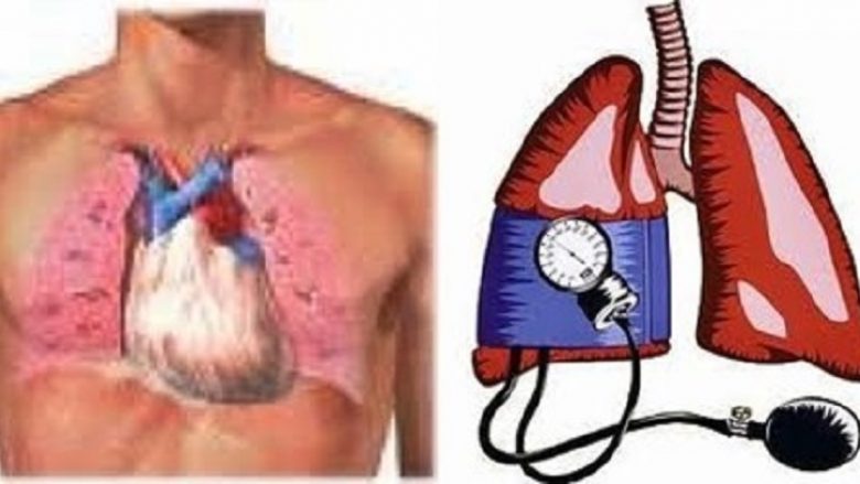 Shoqata për mbrojtjen e personave me hipertension pulmonar në Maqedoni, kërkon ilaçe bazë për trajtimin e sëmundjes