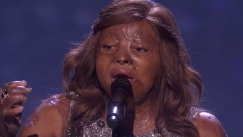 I mbijetoi aksidentit me aeroplan, këngëtarja Kechi emocionoi të gjithë me performancën në “American Got Talent” (Video)