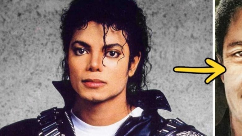 Para dhe pas ndërhyrjeve – Ndryshimi drastik i Michael Jacksonit ndër vite (Foto)