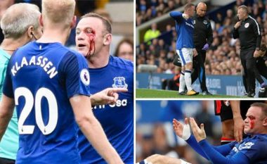 Rooney gjakoset ndaj Bournemouthit, gjyqtari nuk ndali as faull (Foto/Video)