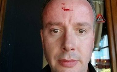 KMDLNJ dënon sulmin ndaj gazetarit Vehbi Kajtazi