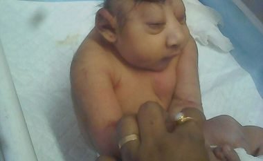 Mjekët nuk mund të bëjnë asgjë për fëmijën e lindur me kokë të rrafshët (Foto)