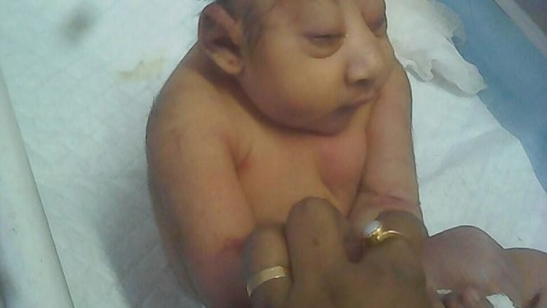 Mjekët nuk mund të bëjnë asgjë për fëmijën e lindur me kokë të rrafshët (Foto)