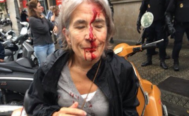 Përgjaket referendumi në Kataloni, policia gjuan me plumba gome votuesit (Foto)